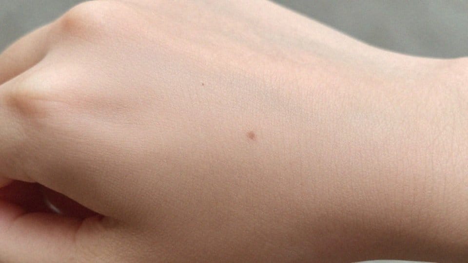 Jakie są etapy gojenia i ile trwają?