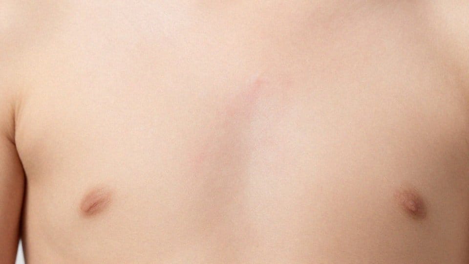 Jak regeneracja nerwów w bliznie powoduje swędzenie?